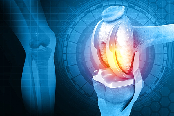 How AI Is Transforming Robotic Knee Replacement